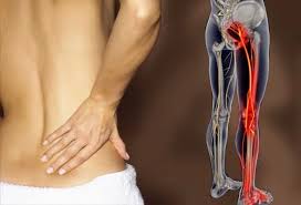 Back problems image 3