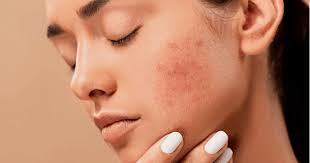 Skin and hair image 3